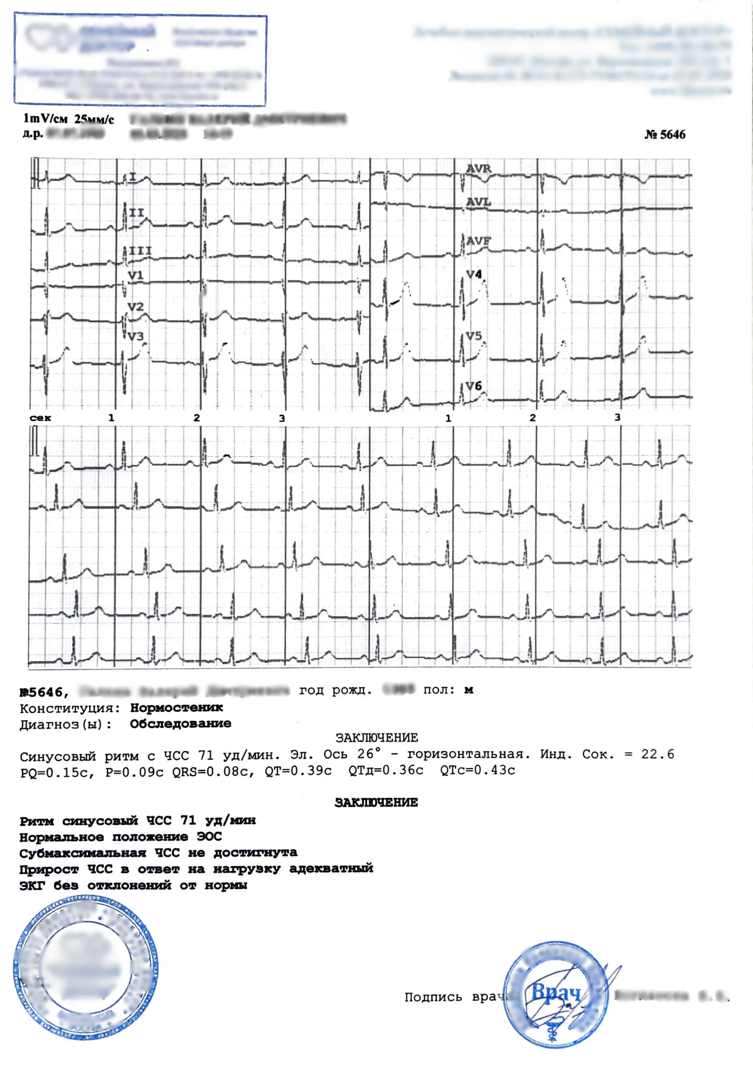 Купить заключение ЭКГ. В Москве.