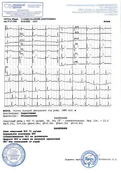 Купить заключение ЭКГ. В Москве.